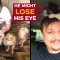 MY FAMILY IS GROWING – New Dog Might Lose His Eye? (Davao, Philippines)